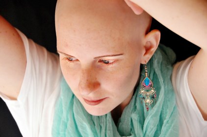 Bald girl dating