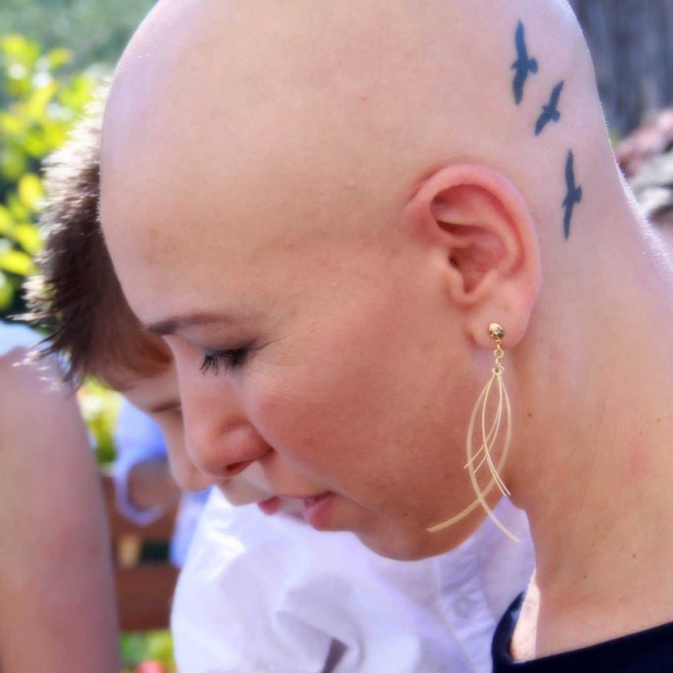 women living with alopecia. talking about alopecia. 